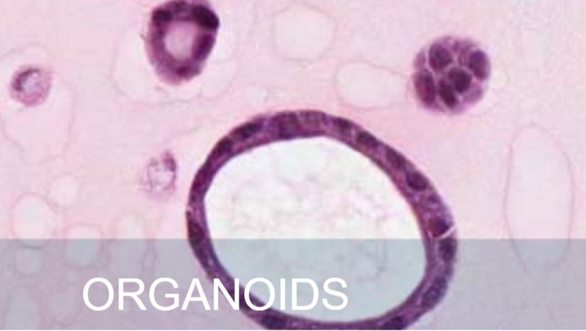 photo of organoids